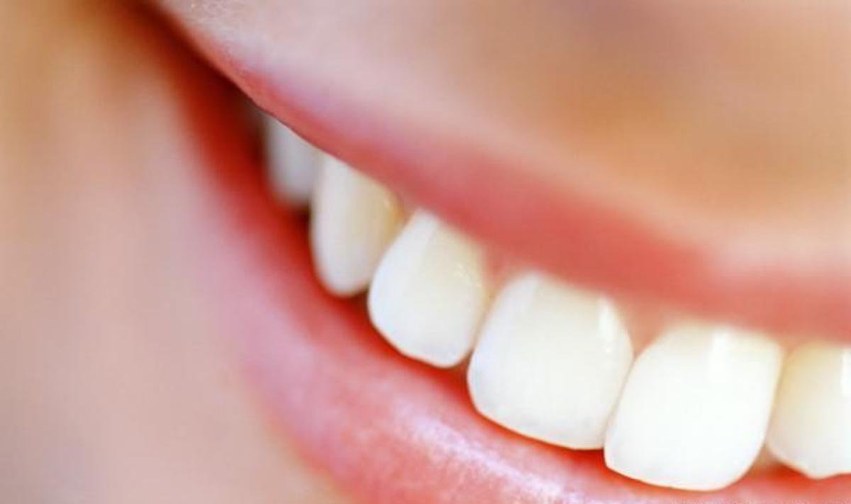 Sorriso saudável